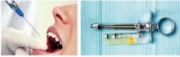 胰島素，牙科麻醉6.png